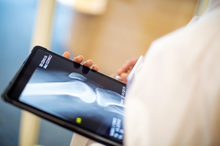 Photo shows doctor looking at x-ray image of a patient/Getty Images